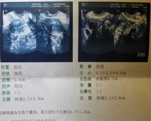 重庆试管几代,重庆私立试管婴儿医院排名？民营医院做试管婴儿可以用医保吗