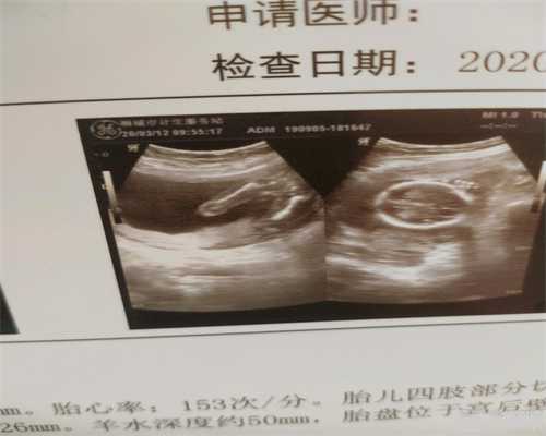 重庆国外正规的代孕机构_重庆代孕花多少钱_重庆