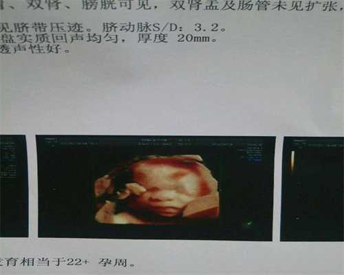重庆专业找代怀孕机构_重庆找女人代生小孩大概