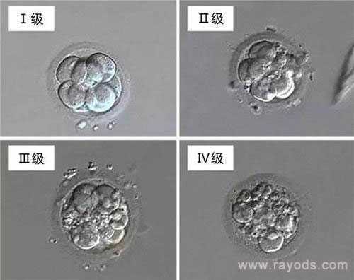 包生男孩重庆代孕网|试管胚胎等级分类，二级胚胎是不是优质胚胎？