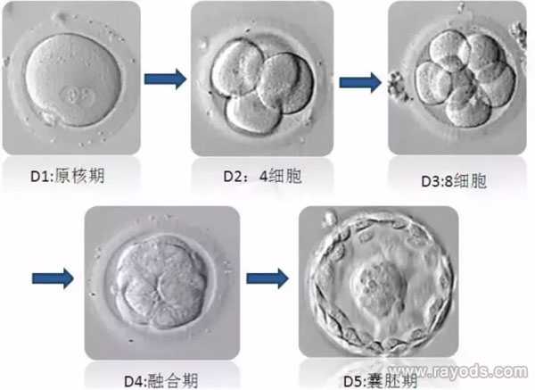 包生男孩重庆代孕网|试管胚胎等级分类，二级胚胎是不是优质胚胎？